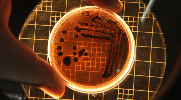 Muestra de una bacteria en un microscopio.