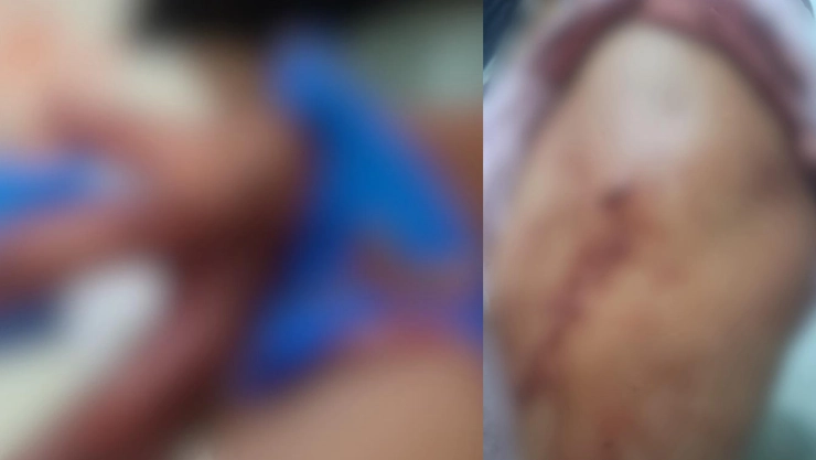 Pelea callejera San Cristóbal puñaladas
