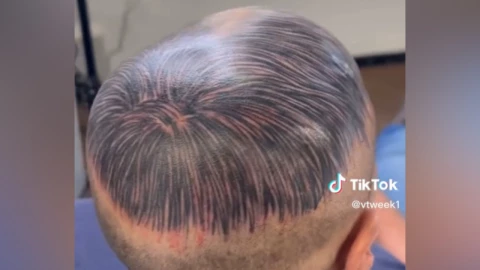 se tatúa la cabeza para disimular calvicie