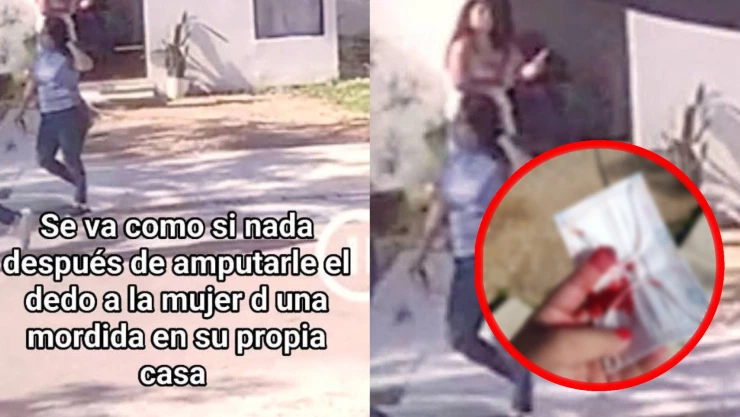 “La Caníbal Yucateca”: Joven asegura que le arrancaron el dedo a mordidas y el caso se viraliza en redes sociales