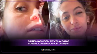 Hija de Michael Jackson muestra severos daños a su nariz; a consecuencia del consumo de sustancias.jpg