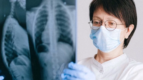 cancer de pulmón sintomas