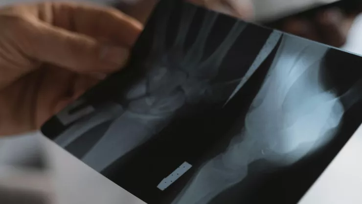 Tyreek Hill se lesiona la rodilla y queda fuera de la temporada