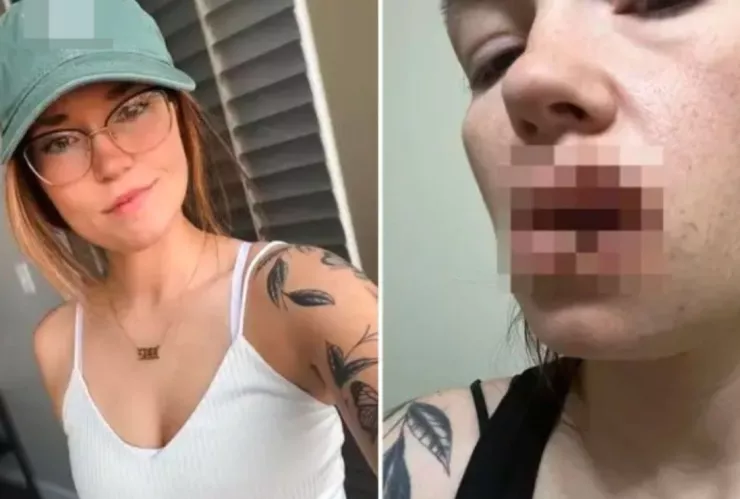 El perro de su mejor amiga le mordió la boca y le desfiguró los labios