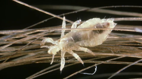 ¿Qué significa soñar con piojos? No es lo que piensas