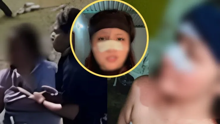 Video mujer sin cara accidente Veracruz