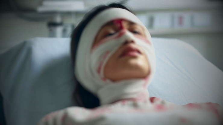 Niño causa graves lesiones en la cara de su madre con un petardo, el accidente quedó grabado en video.png