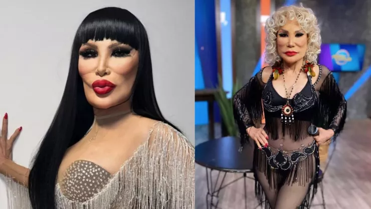 “Vedette solo hay una”: Lyn May sorprende al lucir rostro rejuvenecido en esta foto