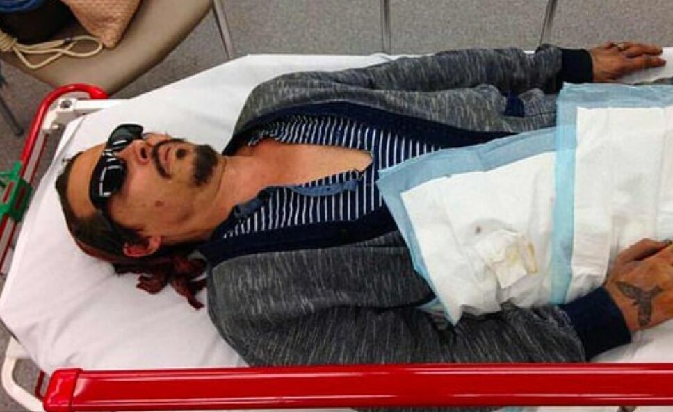 Depp confiesa la verdad sobre el pedazo de dedo que le falta desde 2015
