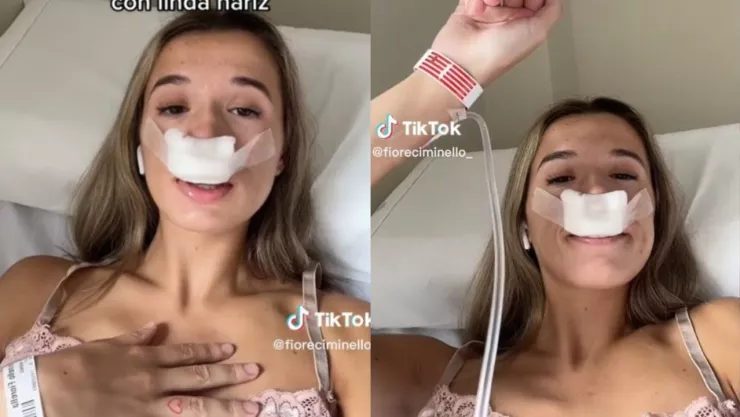 Mujer se hace rinoplastia