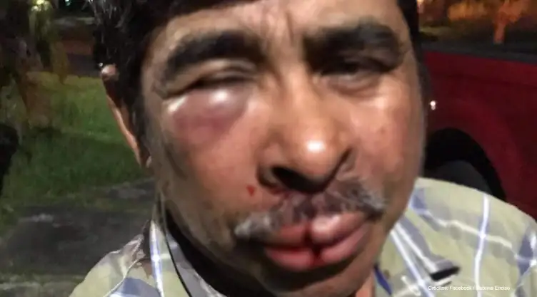 hombre mexicano golpeado miami.jpg