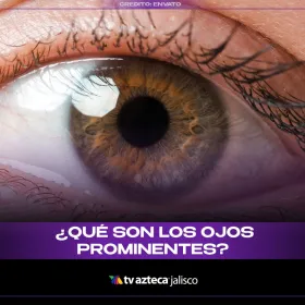 ¿Qué son los ojos prominentes? Caso clínico: ‘Muerte en vida’