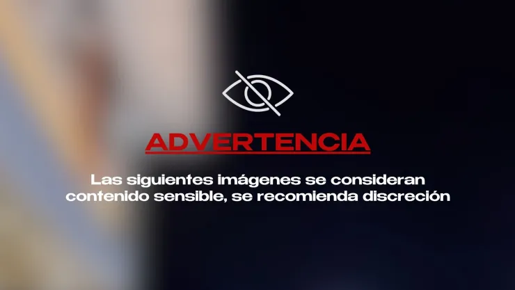 Video: Joven sufre graves lesiones tras fallar acrobacia desde un balcón hacia una alberca