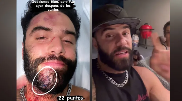 Fernando Lozada revela en La Granja VIP el TERRIBLE asalto que sufrió