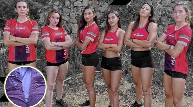 Así quedaron las piernas de esta leyenda de Exatlón México tras una operación