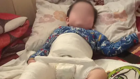 Morgan, niño con atrofia muscular espinal en Mazatlán