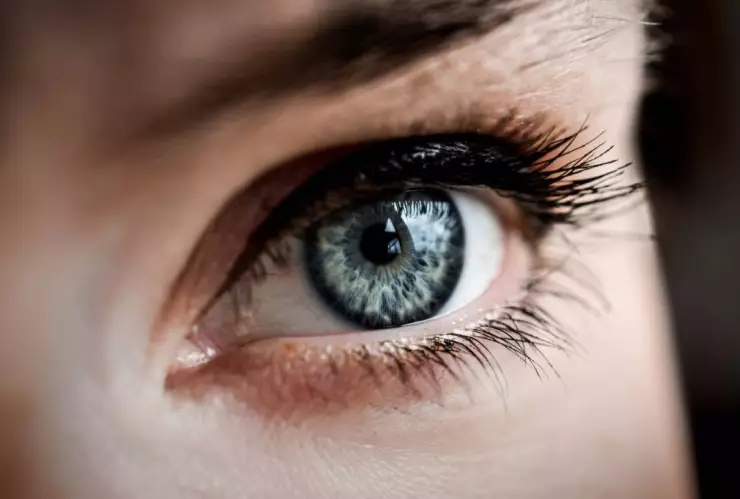 Una mujer tuvo una piedra en el ojo por más de 50 años