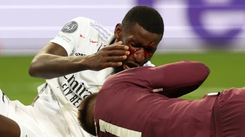 Antonio Rudiger después del choque con el arquero del Shakhtar