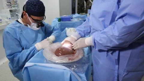 ISSSTE trasplantados Covid (1).jpeg