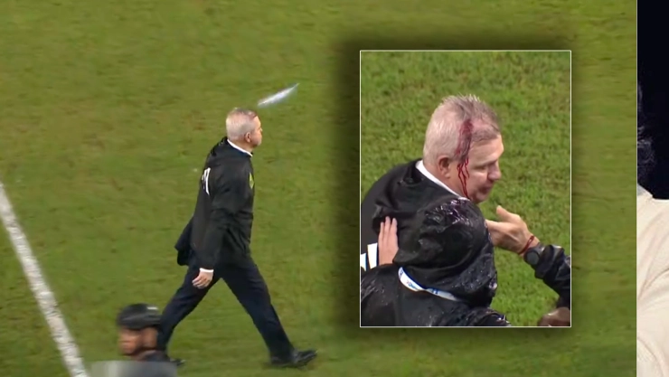 Violencia en el fútbol: Aguirre termina lastimado por ataque en Honduras