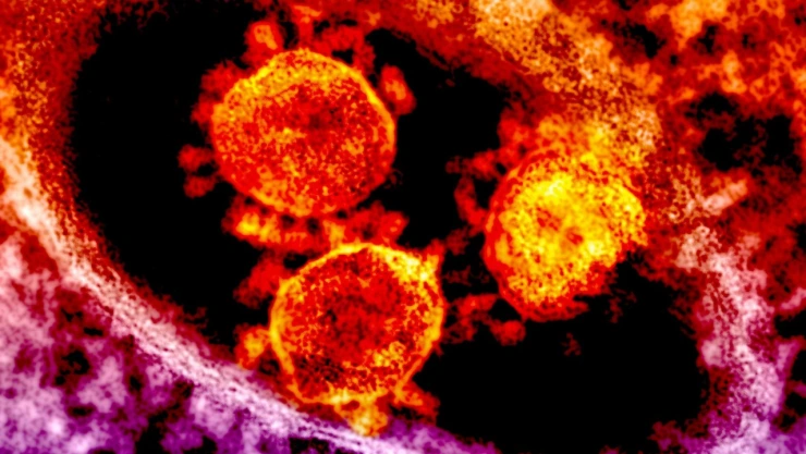 Vibrio vulnificus