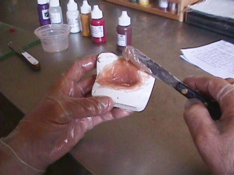 Expertos consideran que en México existe una demanda importante de prótesis faciales