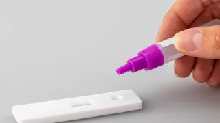 Detectan 9,046 nuevos casos de VIH en México; Jalisco es de los estados con más contagios