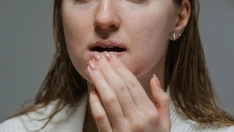 vaselina labios resecos.jpg