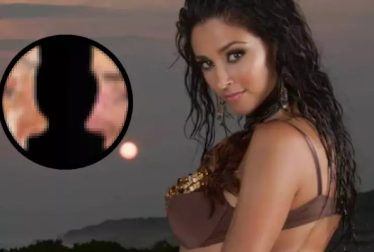 Dorismar: Así luce su nueva nariz tras mala cirugía que le deformó el rostro