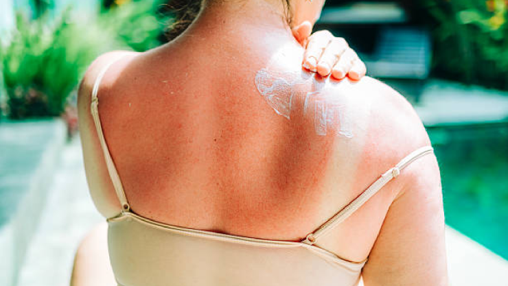 Protección contra rayos UV