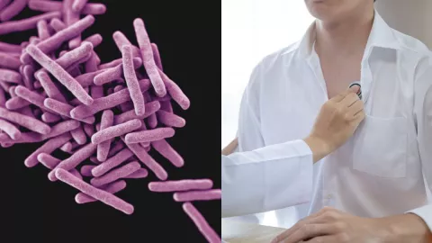 Tuberculosis