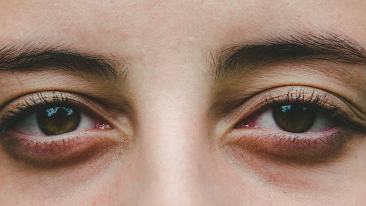 Queratopigmentación, operación para cambiar el color de tus ojos