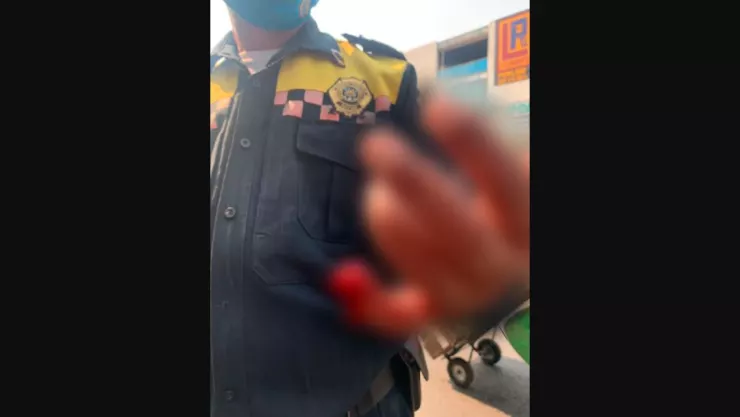 Sujeto arranca dedo a policía de tránsito por inmovilizar su auto