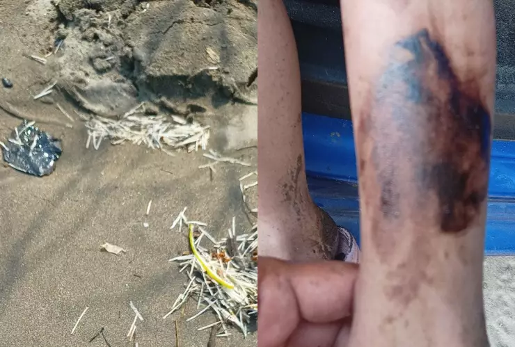 Chapopote en Playas de Alvarado