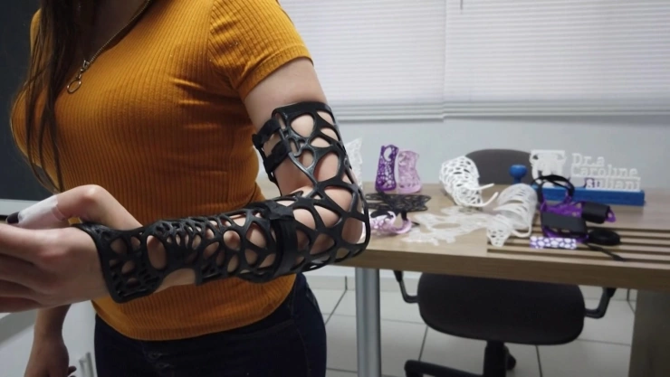 En Brasil jóvenes crearon un molde ecológico que sustituye al yeso.