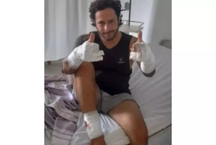 Terror en San Andrés_ ‘Estoy Completo’ Apneista colombiano es atacado por un tiburón.jpg