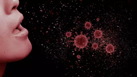 tos ferina veracruz.