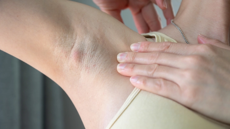 Los trucos para cuidar tus axilas