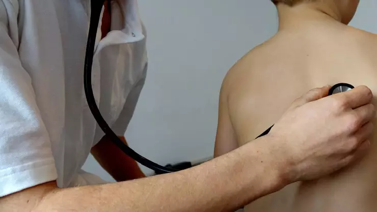 Casos de tos ferina en México