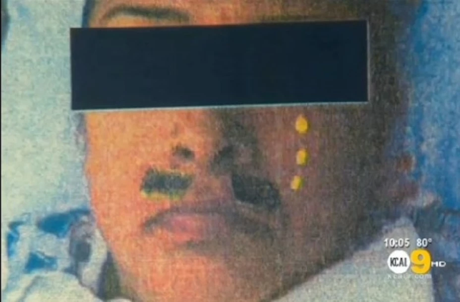 A la paciente le pareció cruel y poco profesional que le jugaran una broma en la sala de operaciones