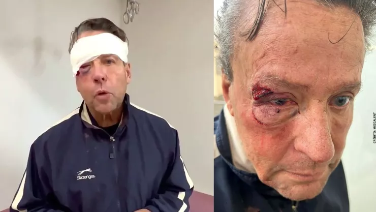 Así fueron las fracturas que tuvo Alfredo Adame tras golpiza.