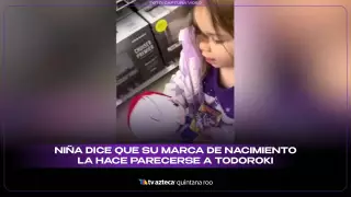 Pequeña fan de anime: Niña dice que su marca de nacimiento la hace parecerse a Todorok
