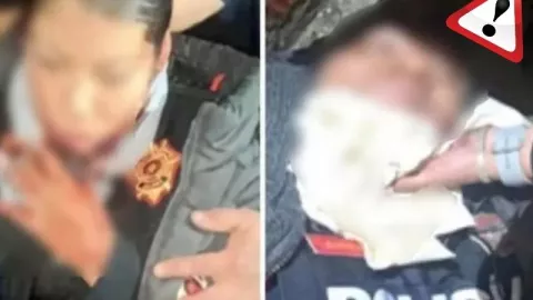 IMÁGENES FUERTES: Policía intenta degollar a su compañera en pleno servicio y luego intenta suicidarse en CDMX