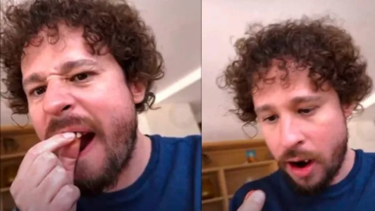 Luisito Comunica sin dientes