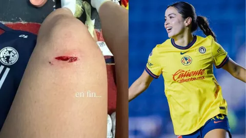 Lesión Scarlett Camberos en América