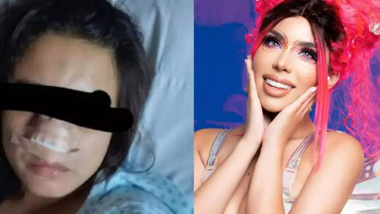 Yeri Mua pagará cirugía a mujer que fue morida en la nariz