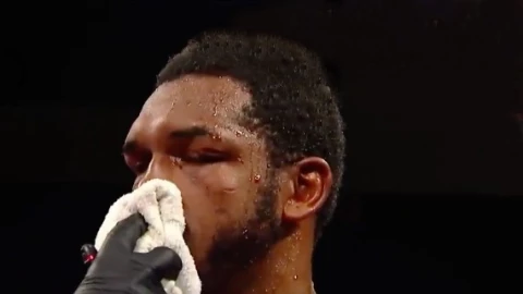 Tureano Johnson labio roto box