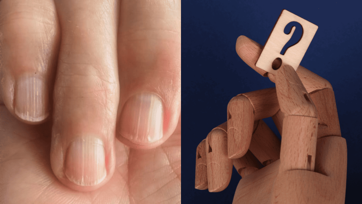 ¿Por qué aparecen las uñas estriadas y cómo evitarlas.png