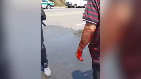 Accidente Puerto Madero