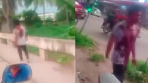 Escenas de horror en Álvaro Obregón: machete causa amputación